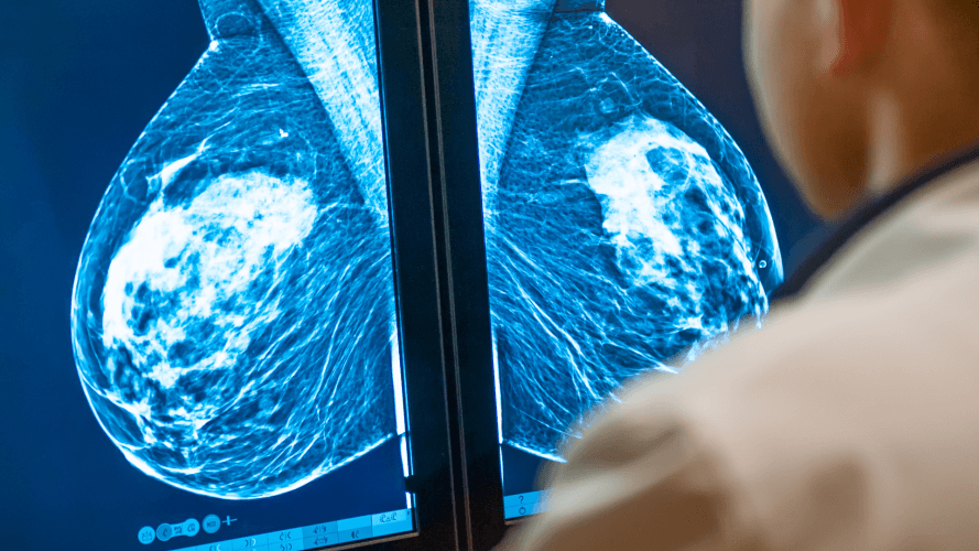 dépistage cancer du sein - Programme vaudois du dépistage du cancer du sein 