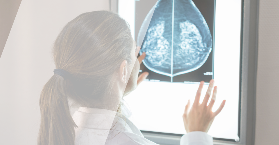 cancer sein mammographie