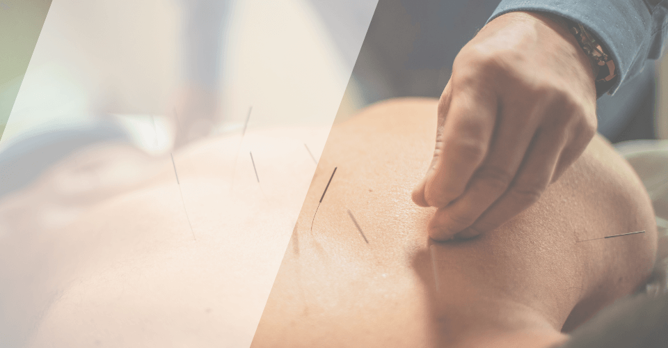 medecine complementaire acuponcture