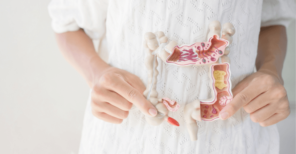 maquette de microbiote avec intestin